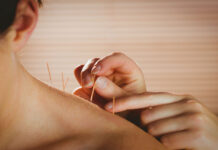Healing After Impact: How Car Accident Acupuncture Can Alleviate Pain and Promote Recovery